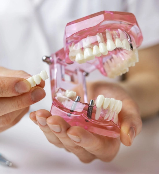 Can dental implants cause neurological issues
